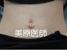 凸出