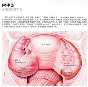 附件
