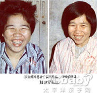 痴笑