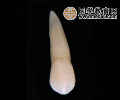 尖牙