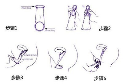 方法