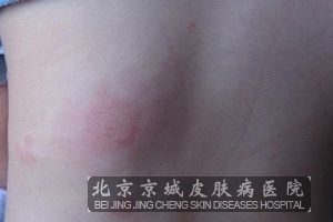 背上