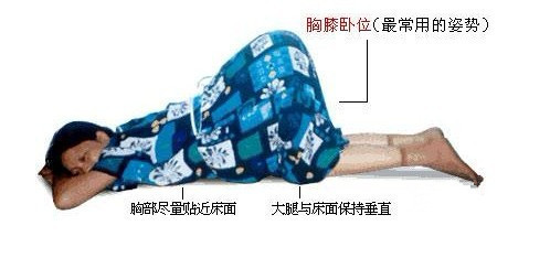 纠正
