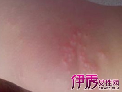 拦腰