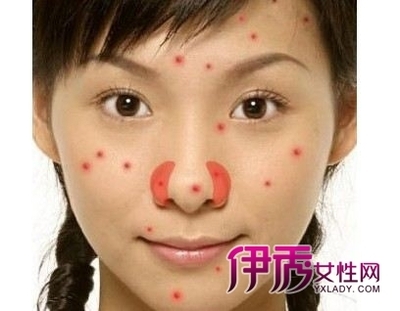 两侧
