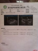 照影