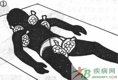 高热
