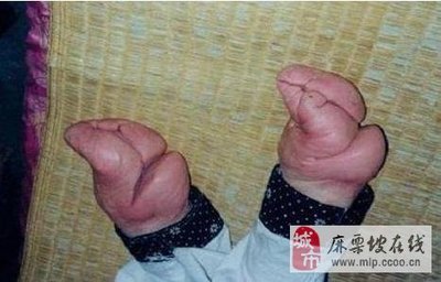 裹足