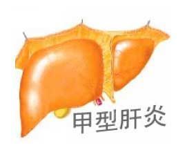 甲肝