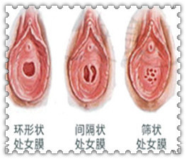 落红