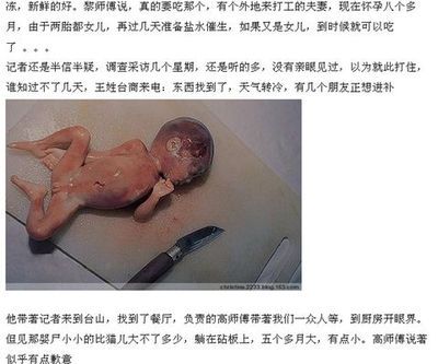 女婴