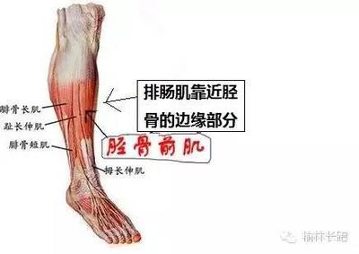 前侧