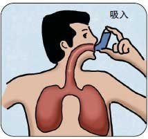 吸入