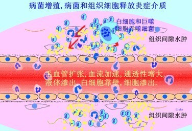 炎症