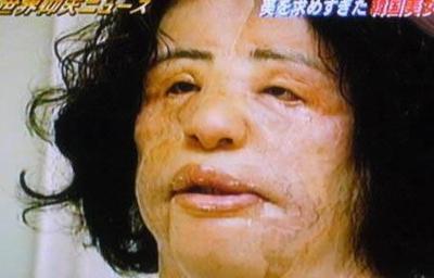 整容