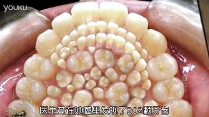 肿痛