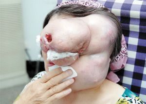 眼圈