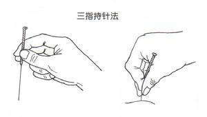 针刺