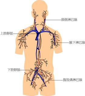 淋巴