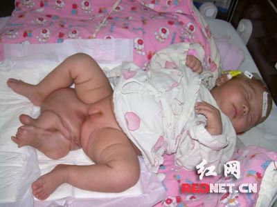 毛毛