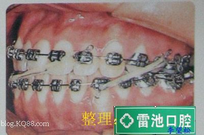 偏斜