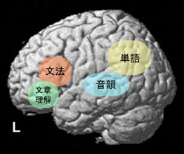 失语