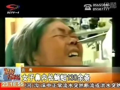 螽斯