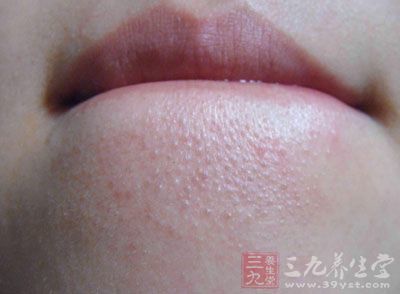 闭口